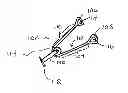 Fig. 01 - SYSTEMS AND METHODS FOR TREATMENT OF SLEEP APNEA