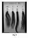 Fig. 06 - Hair treatment and revitalizing composition and methods