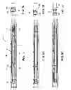 Fig. 02 - Multi-cycle circulating tool
