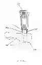 Fig. 04 - Apparatus for an orthopedic fixation system