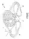 Fig. 08 - GOLF BRACELET WITH REMOVABLE BALL MARKER