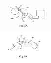 Fig. 05 - CAPACITIVE SENSING DEVICE