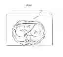 Fig. 06 - Method and apparatus for creating model of patient specified target organ