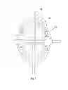 Fig. 06 - Automatic surgical lighting device and its lighting method