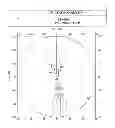 Fig. 19 - Progressive ophthalmic lens