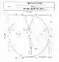 Fig. 25 - Progressive ophthalmic lens