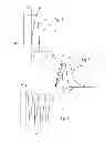 Fig. 04 - Device and Method for Detecting Ophtalmic and/or Brain Diseases