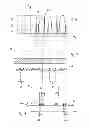 Fig. 05 - Device and Method for Detecting Ophtalmic and/or Brain Diseases