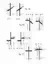 Fig. 07 - Device and Method for Detecting Ophtalmic and/or Brain Diseases