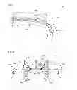 Fig. 05 - Light delivery component and laser system employing same