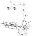Fig. 04 - Damped EGT probe