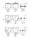 Fig. 02 - Hearing instrument transduction apparatus using ferroelectret polymer foam