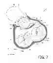 Fig. 08 - Developer supply device with wall between chambers having two heights
