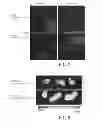 Fig. 07 - Particle composition and pharmaceutical composition using particle composition
