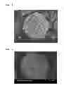 Fig. 02 - Anode active material having high density and preparation method thereof