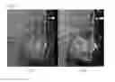Fig. 02 - WIRE FOR CORRECTING BIMAXILLARY PROTRUSION, AND BIMAXILLARY PROTRUSION CORRECTION SYSTEM COMPRISING SAME