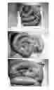 Fig. 01 - Minimizing intestinal dysfunction