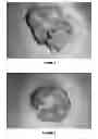 Fig. 02 - Minimizing intestinal dysfunction