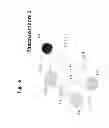 Fig. 58 - Method of inhibiting tau phosphorylation
