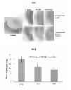 Fig. 02 - PHARMACEUTICAL COMPOSITION FOR PREVENTING OR TREATING MACULAR DEGENERATION