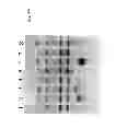 Fig. 06 - METHOD FOR DETECTION OF PATHOGENIC ORGANISMS