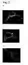 Fig. 03 - Methods for the identification and repair of amino acid residues destabilizing single-chain variable fragments (scFv)
