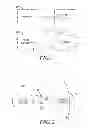 Fig. 02 - Apparatus and method pertaining to determining a spatially-variant normal tissue constraint as a function of dose distribution