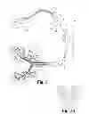 Fig. 02 - Nebulizing catheter for bronchial therapy