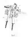 Fig. 02 - Method and apparatus for performing spinal surgery