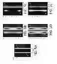 Fig. 06 - Photoacoustic apparatus and control method thereof