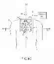 Fig. 04 - Cardiac navigation system including electrode array for use therewith