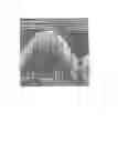 Fig. 06 - Methods for stent strut detection and related measurement and display using optical coherence tomography