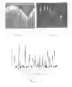 Fig. 09 - Methods for stent strut detection and related measurement and display using optical coherence tomography