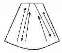 Fig. 01 - Automatic doppler gate positioning in spectral doppler ultrasound imaging
