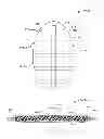 Fig. 10 - Methods and dressing systems for promoting healing of injured tissue