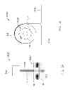 Fig. 14 - Methods and dressing systems for promoting healing of injured tissue