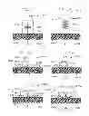 Fig. 15 - Methods and dressing systems for promoting healing of injured tissue
