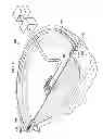 Fig. 05 - Reduced-pressure system and method employing a gasket