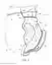 Fig. 04 - Absorbent insert