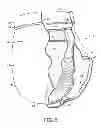 Fig. 09 - Absorbent insert and containment system