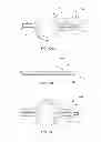 Fig. 06 - SELF-CENTERING CATHETER WITH ANTI-OCCLUSION FEATURES