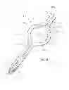 Fig. 07 - SELF-CENTERING CATHETER WITH ANTI-OCCLUSION FEATURES