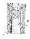 Fig. 02 - Catheter deployment device