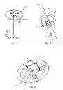 Fig. 03 - EXTERNAL FIXATION SYSTEM FOR PERCUTANEOUS DRAINAGE PROCEDURES
