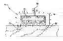 Fig. 01 - Instruments and methods for thermal tissue treatment