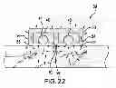 Fig. 07 - Instruments and methods for thermal tissue treatment