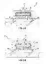 Fig. 09 - Instruments and methods for thermal tissue treatment