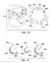 Fig. 20 - Method and apparatus for magnetically guided catheter for renal denervation employing MOSFET sensor array