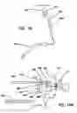 Fig. 24 - Method and apparatus for magnetically guided catheter for renal denervation employing MOSFET sensor array