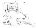 Fig. 01 - Electrosurgical wand and related method and system